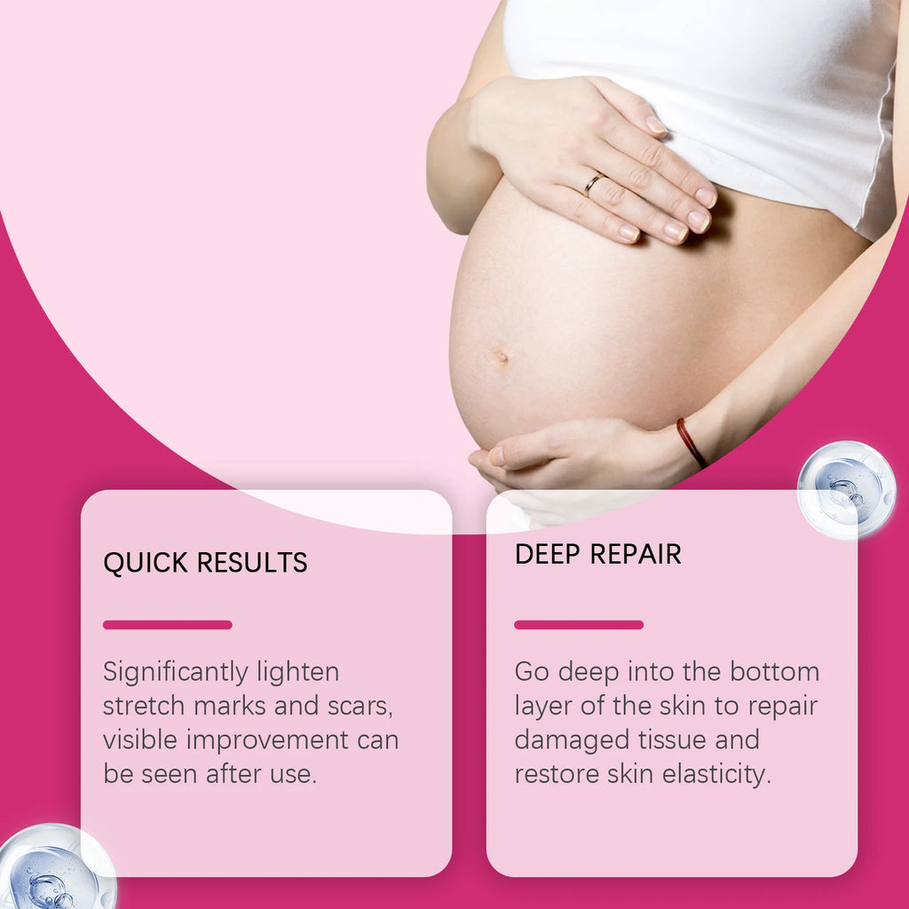 Stretch Marks Removal Lotion Pregnancy Skin Care Smooth