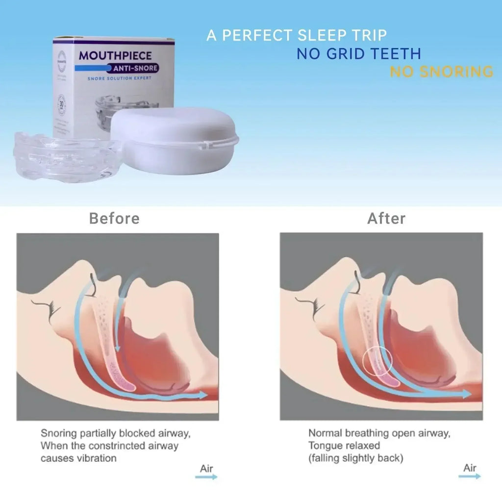 Adjustable Mouthpiece  Anti-Snoring Mouth Guard Night Time Teeth & Sleeping Bite Guard for Bruxism and Stop Snoring