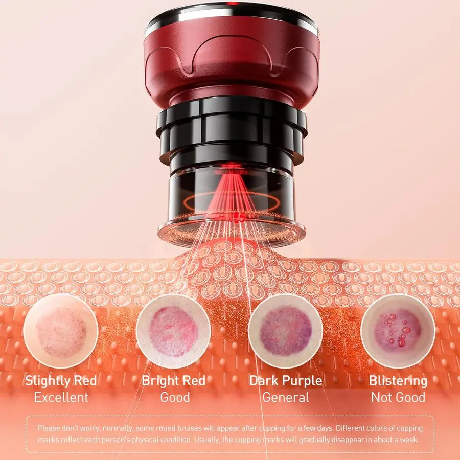 Smart Cupping Therapy Set Cellulite Massager with 6 Massage Cups