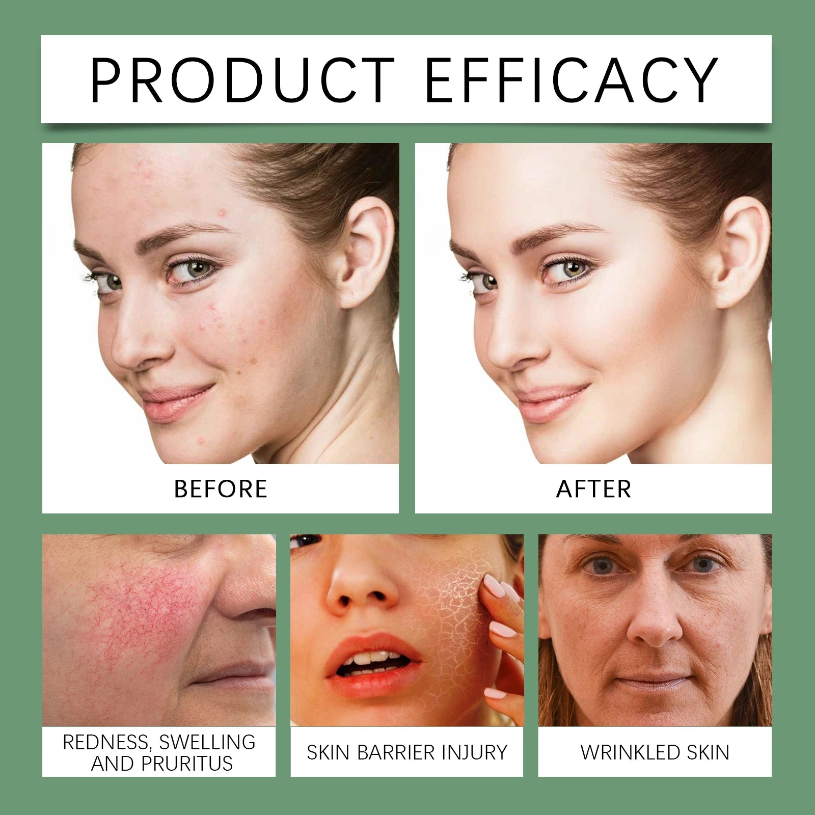 Resurrection Herb Soothing Cream, Centella Asiatica Extract, Hyaluronic Acid, Selaginella Extract, Face, Relieves Dryness