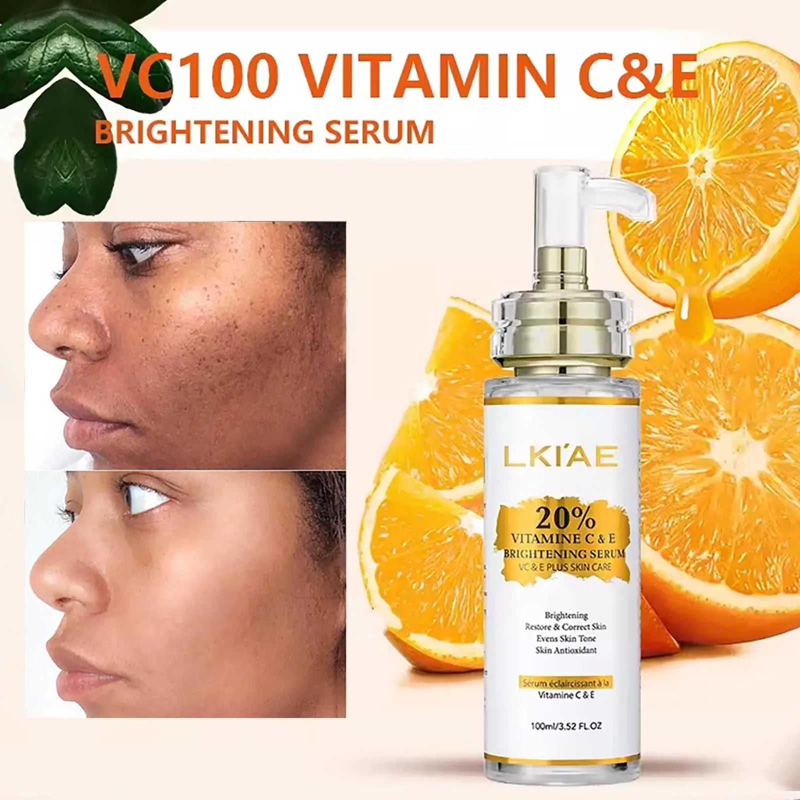 Vitamin C Skin Care Set, with Lightening Body Lotion, Even Skin Tone Face Cream, Whitening Serum, Brightening Soap