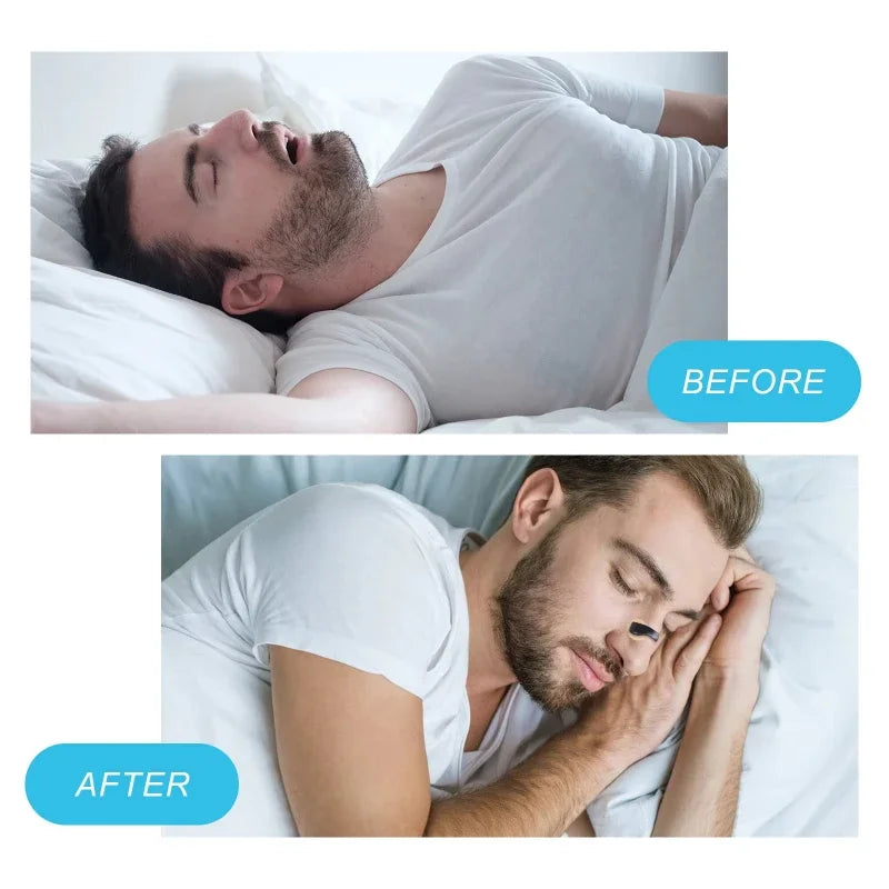 5/15/30days Magnetic Nasal Dilator Starter Kits